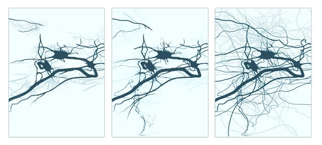 Redes neuronales antes y después del entrenamiento cerebral